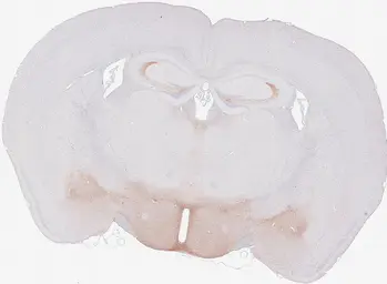 Anti-Chromogranin C antibody [HL2992] used in IHC (Paraffin sections) (IHC-P). GTX640402